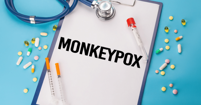 monkeypox